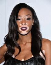 Winnie Harlow